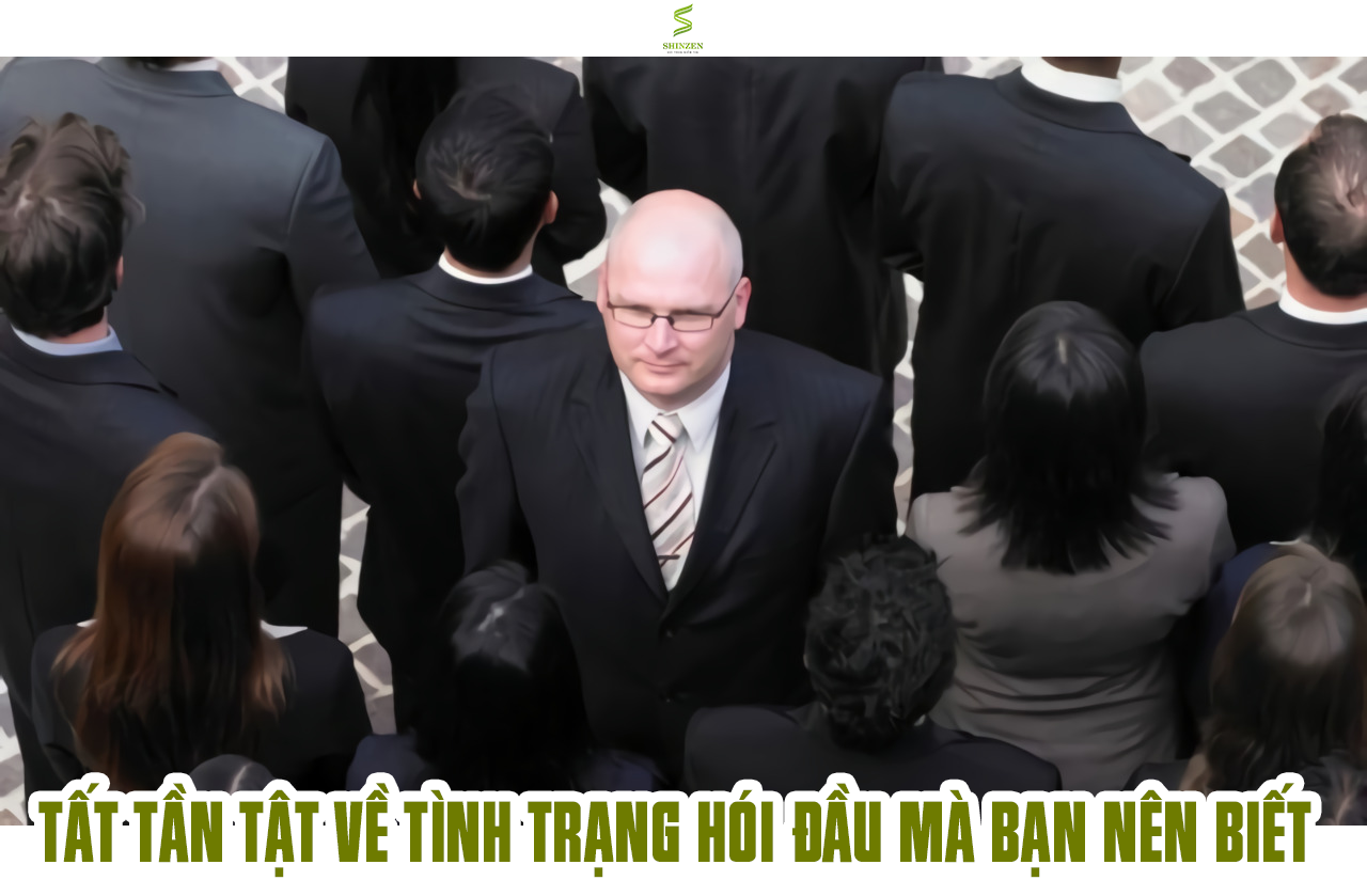 TẤT TẦN TẬT VỀ RỤNG TÓC DO DI TRUYỀN?