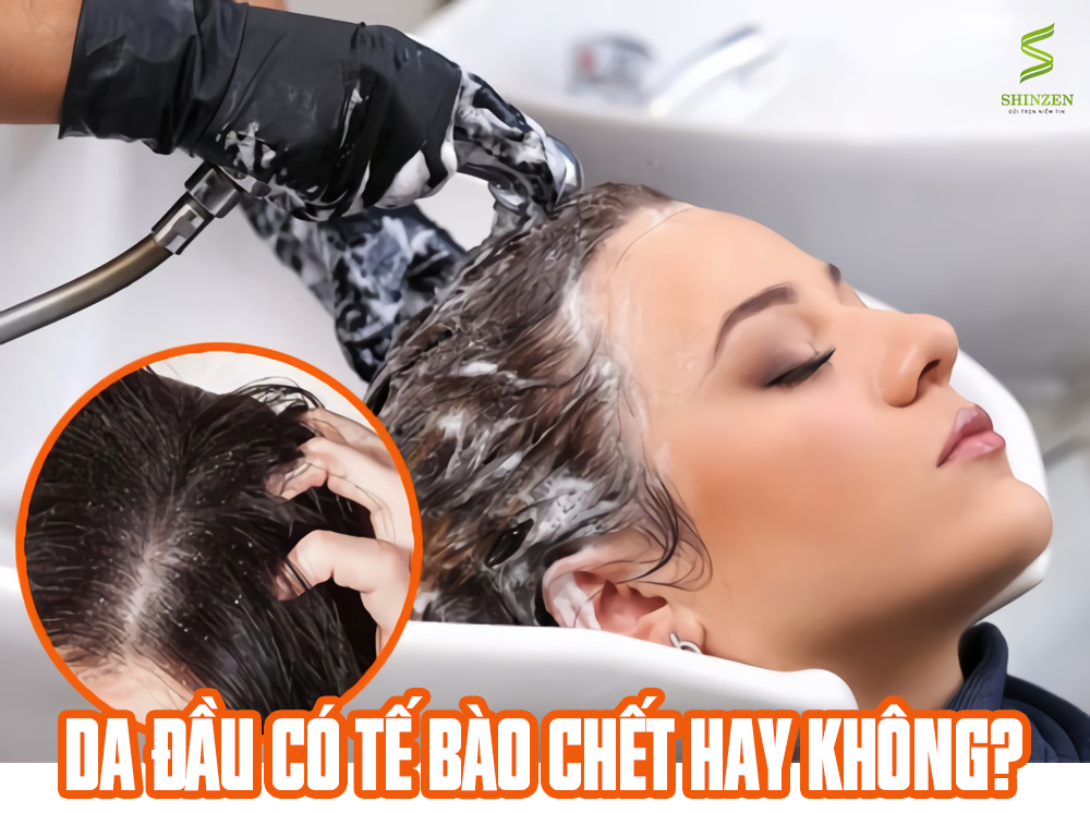DA ĐẦU CÓ TẾ BÀO CHẾT HAY KHÔNG?