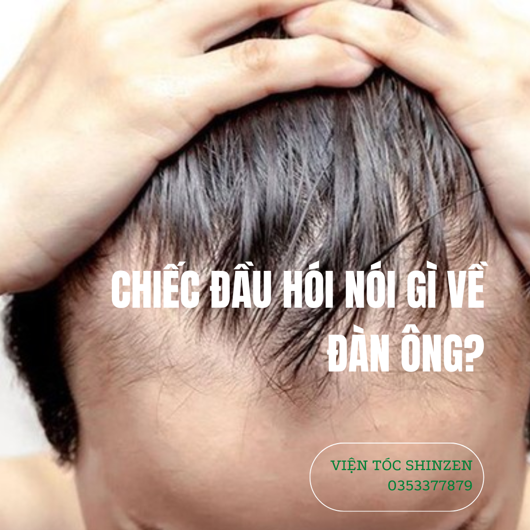 CHIẾC ĐẦU HÓI NÓI GÌ VỀ ĐÀN ÔNG?