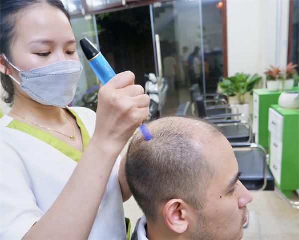 KÍCH MỌC TÓC CHUYÊN SÂU
